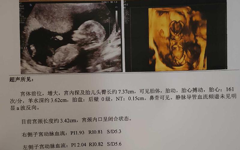 武汉三代供卵试管生男孩(武汉三代供卵试管生男孩的奇迹故事)